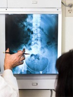 Back Pain X-ray